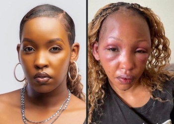 Weasel Manizo Reportedly Turns Baby Mama Into a Punching Bag
