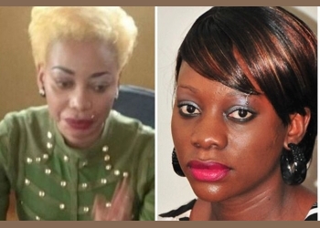 Bad Black to go for another plastic surgery