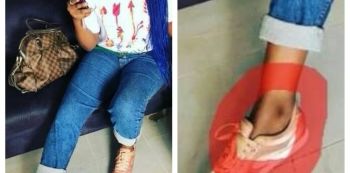 Irene Ntale Struggling With Fake Bleaching Creams