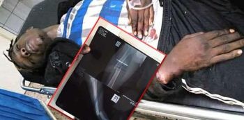 Local Singer Pyno In Critical Condition After A Fatal Accident (Scan Images)