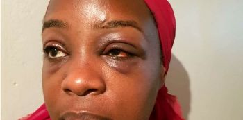 Angella Katatumba demands 1 Billion from Chicken Tonight