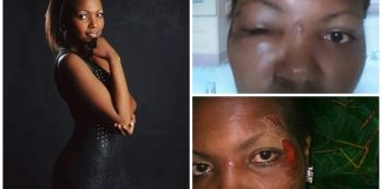 Love Gone Sour! Kenyan Man Beats And Kills Lover Over An Argument
