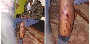 Violent Clashes Erupt In Fort Portal; Lt. Gen. Tumukunde Shot