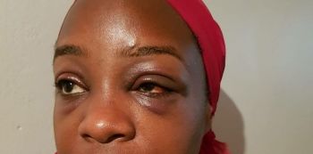 Singer Angella Katatumba Thumped By Chicken Tonight Staff