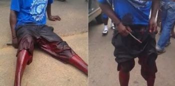 Man's Private Part Chopped Off In A Market