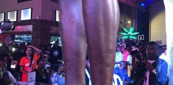 Roden Y's Legs Full Of Scars Worry Fans At Freedom City