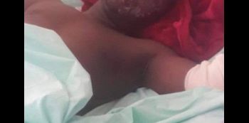 Comedian King Kong Improving, Now Off Oxygen Therapy