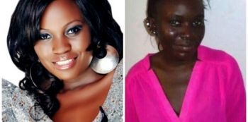 More Prayers As Jackie Chandiru’s Skin Worryingly Peels Off