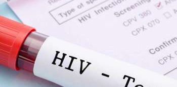 Government launches media campaign to end HIV