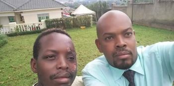 Comedian King Kong Now Fully Recovered