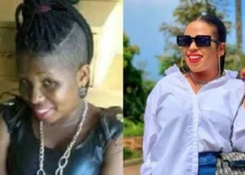 Bleaching Is Expensive - Prima Kardashi