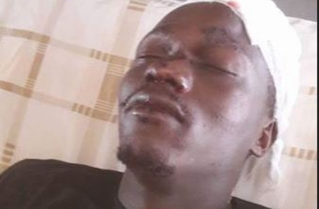 Local Singer Hospitalized After Goons Hack His Head With A Panga