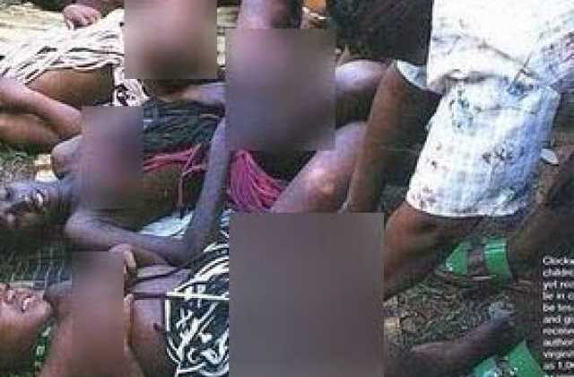 Genital Elongation (Pulling) among Baganda classified as Female Genital Mutilation, causes Lesbianism 