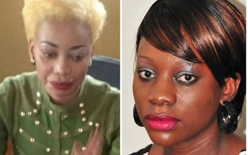 Bad Black to go for another plastic surgery