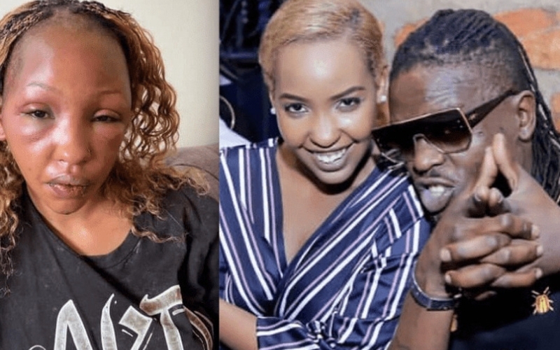 Weasel has never beaten me - Sandra Teta