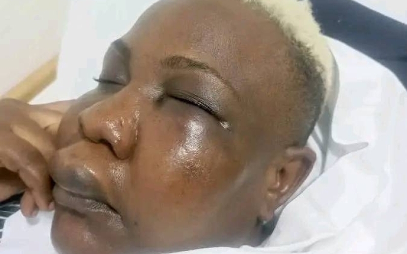 Full Figure Thumped by Goons at NRM Headquarters