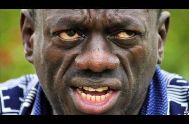 According to Besigye, a dictatorship can't be defeated through polls. 