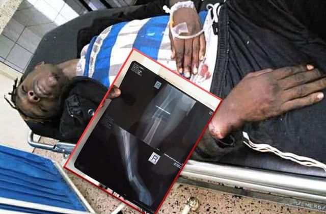 Local Singer Pyno In Critical Condition After A Fatal Accident (Scan Images)