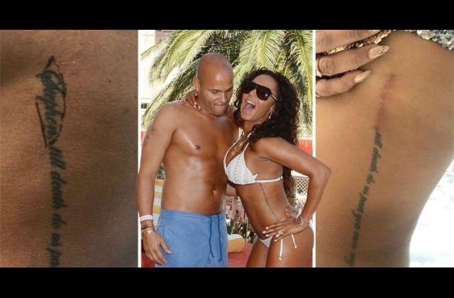 Mel B Undergoes Surgery To Remove The Tattoo Of Her Ex Husband's Name.