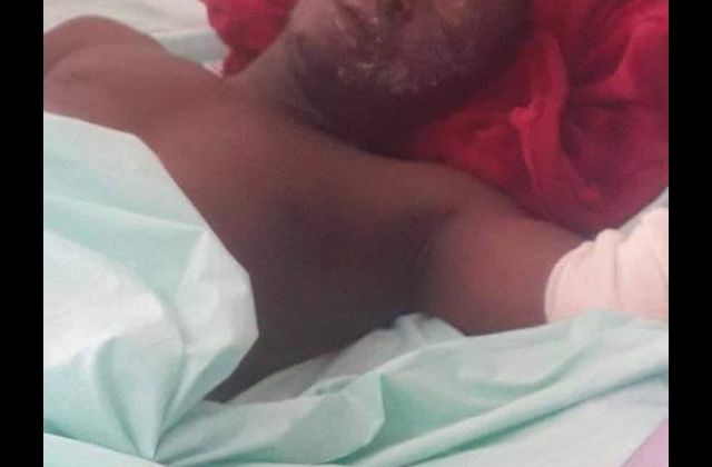 Comedian King Kong Improving, Now Off Oxygen Therapy