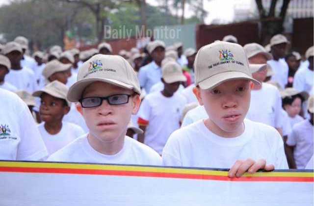 Annual Parliament Week 2020 kicks off with Charity walk to raise funds for persons with Albinism