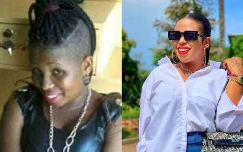 Bleaching Is Expensive - Prima Kardashi